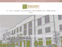 Tablet Screenshot of dentalimplantac.com
